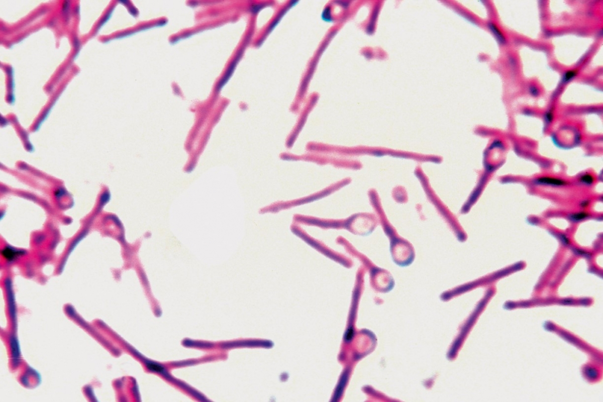 Столбняк возбудитель. Столбнячная палочка Clostridium tetani. Бактерией Clostridium tetani. Clostridium tetani микробиология. Клостридии Ожешко.